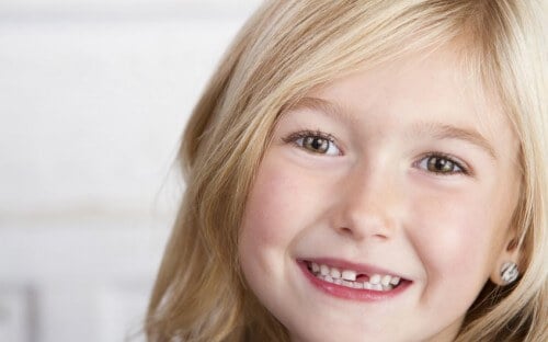 Little girl smiling with her front tooth lost